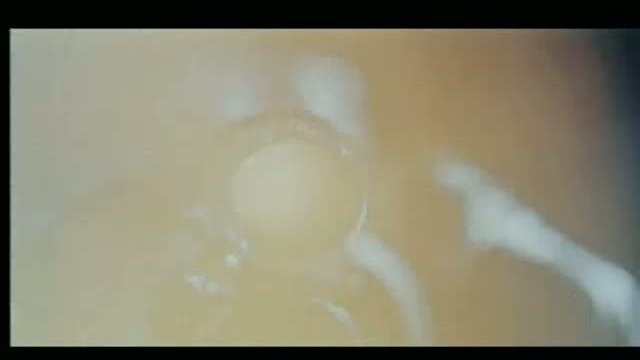 The Hitman 1. Fragmanı