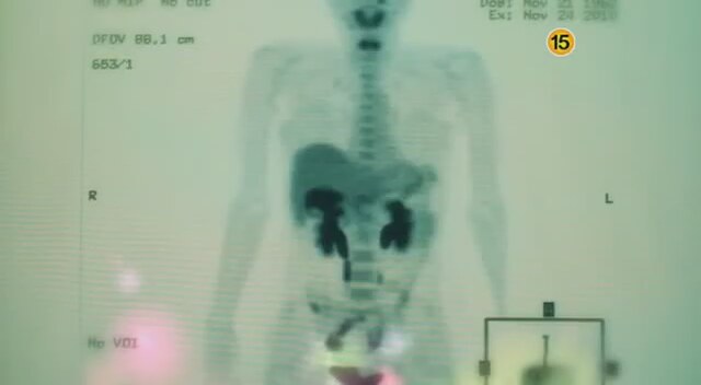 Tears Of Africa (2010) Fragman